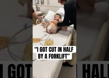 “I Were given Minimize In Part Via A Forklift” #shorts #viralshort #surgical operation